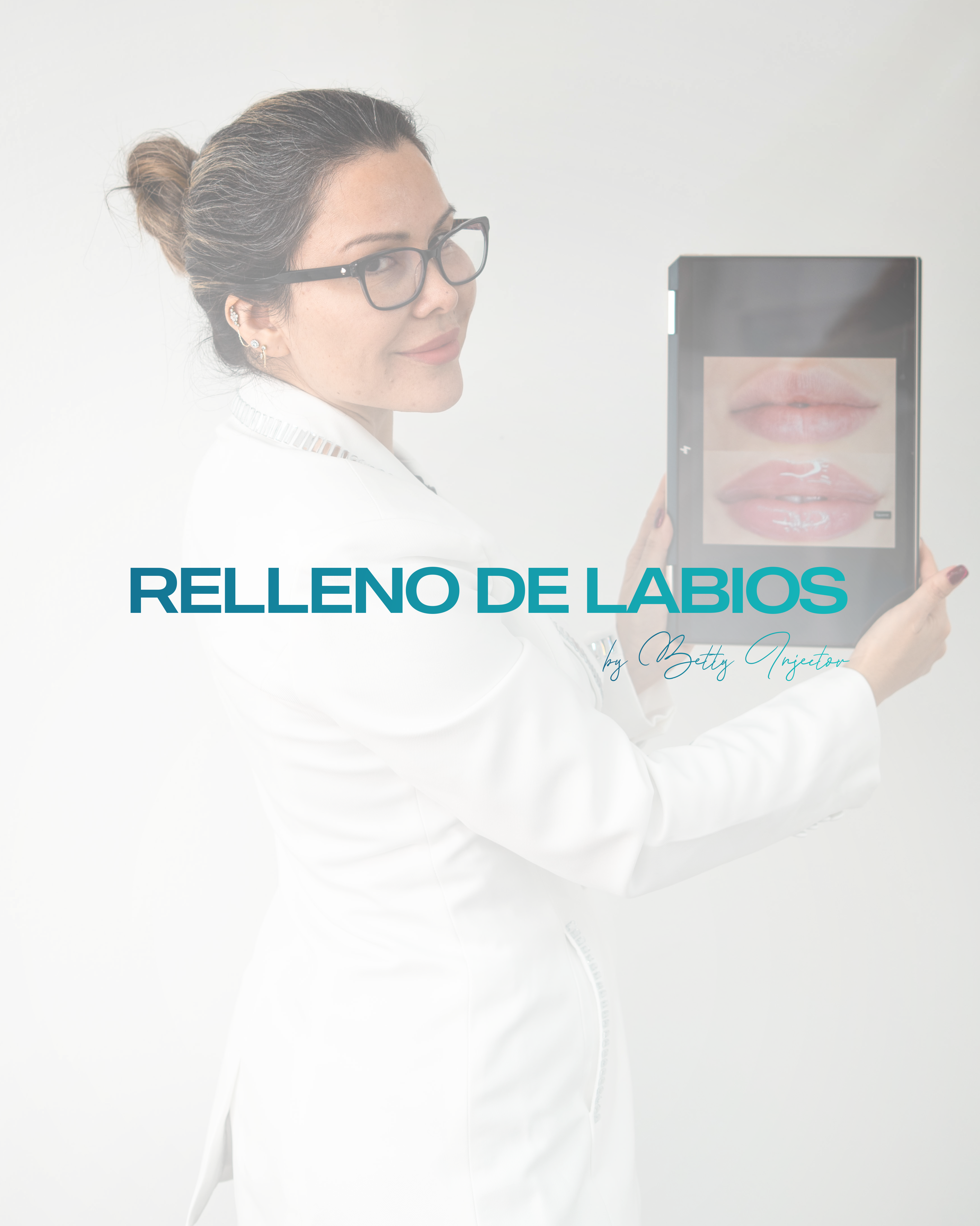 Relleno de Labios
