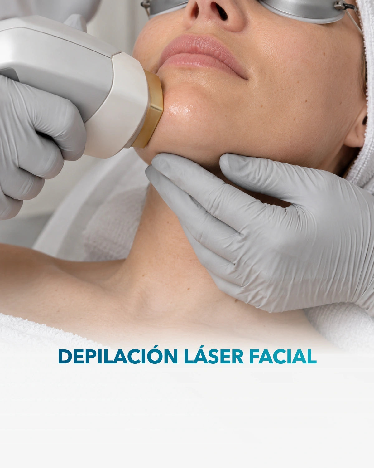 Depilación láser facial — procedimiento en Clínica Adhara