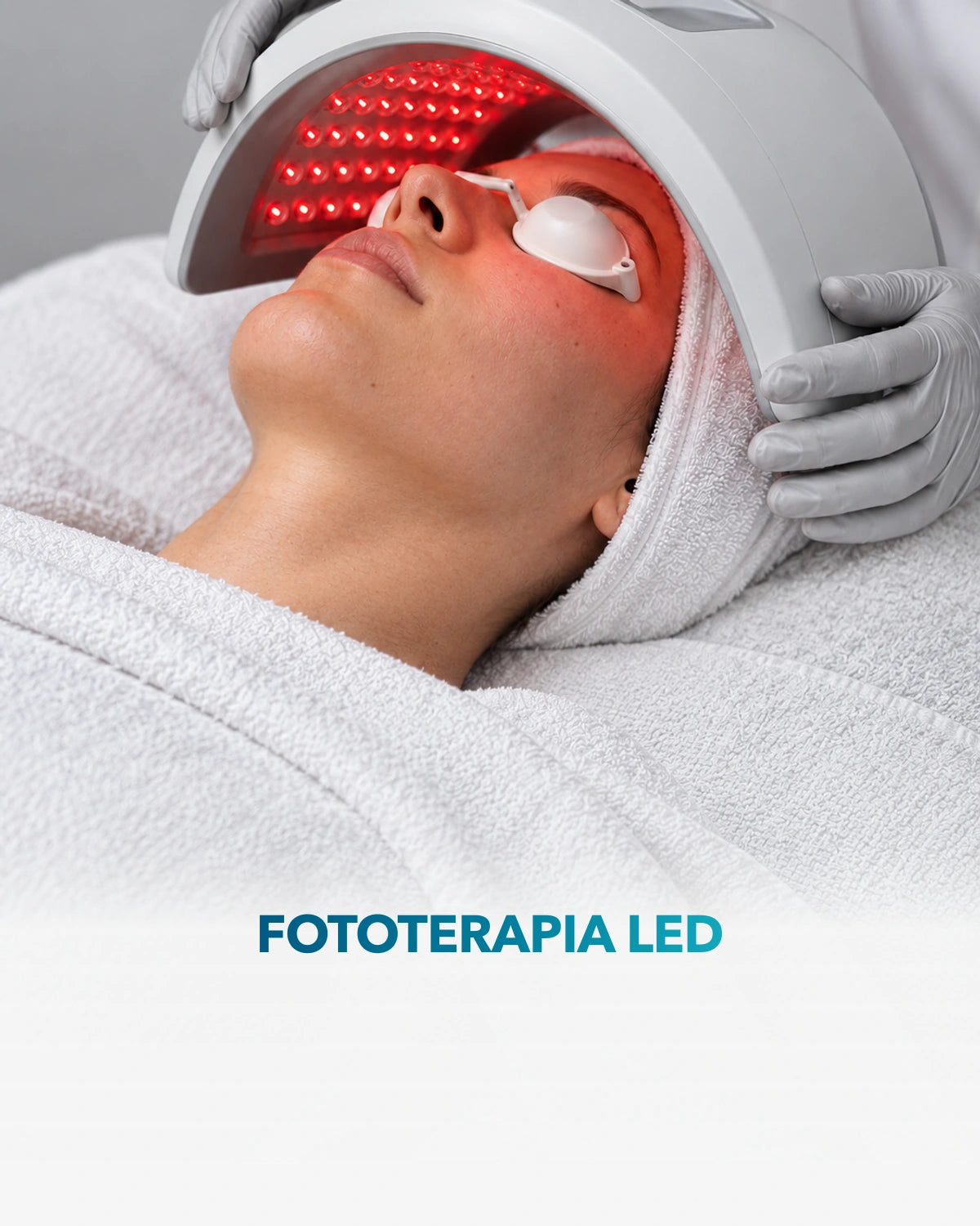 Fototerapia LED — procedimiento en Clínica Adhara