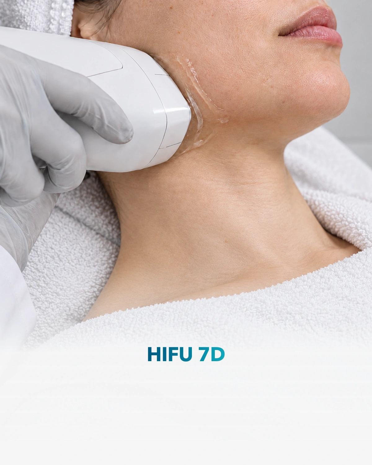 HIFU 7D — procedimiento en Clínica Adhara
