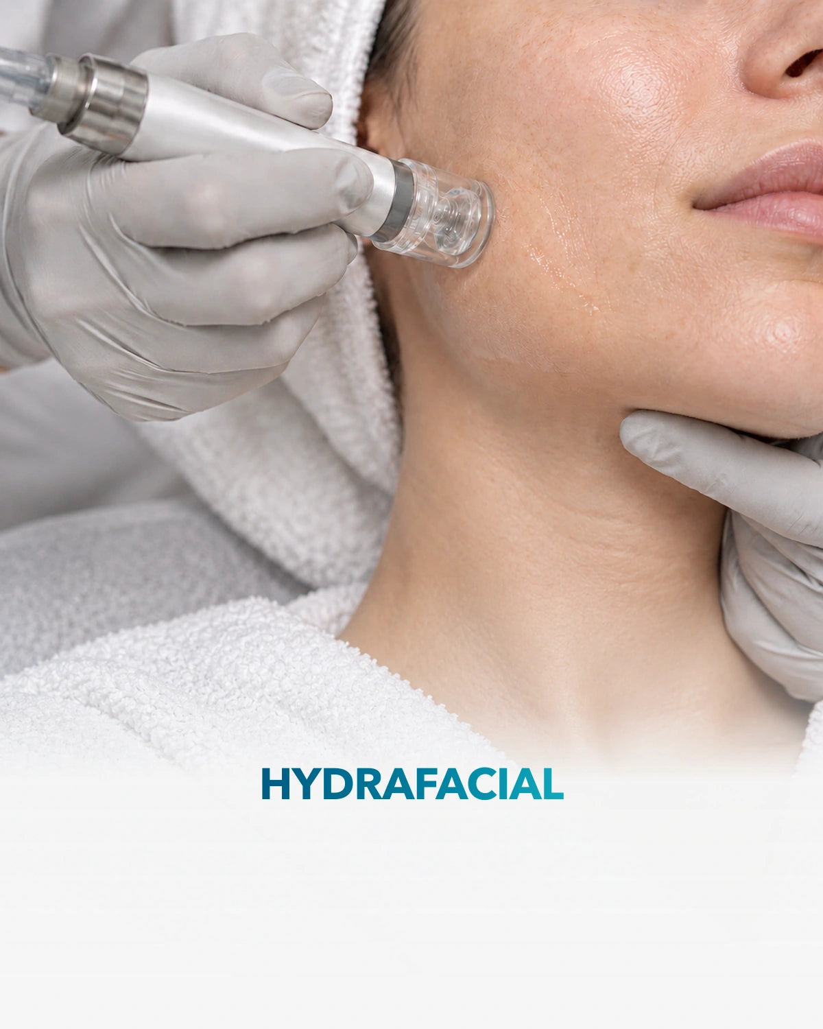 Hydrafacial — procedimiento en Clínica Adhara